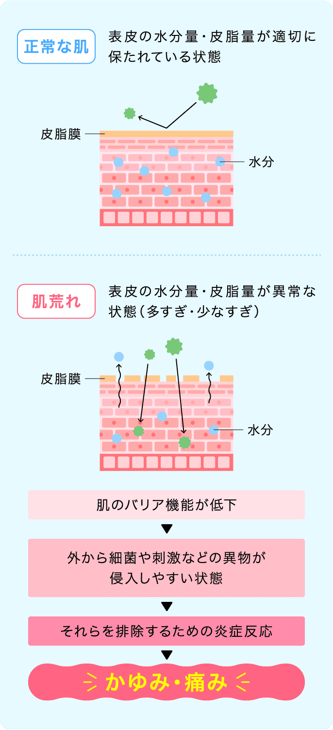 正常な肌：表皮の水分量・皮脂量が適切に保たれている状態　肌荒れ：表皮の水分量・皮脂量が異常な状態(多すぎ・少なすぎ)　肌のバリア機能が低下→外から細菌や刺激などの異物が侵入しやすい状態→それらを排除するための炎症反応→かゆみ・痛み