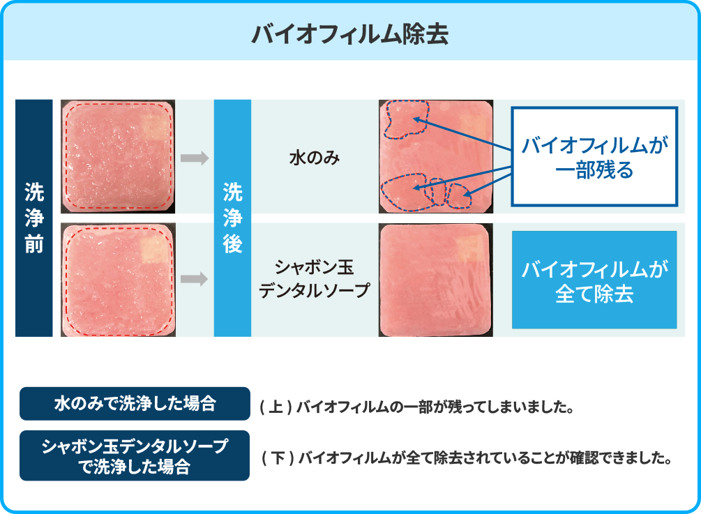 バイオフィルム除去